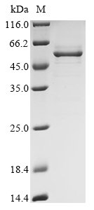 Infectious bronchitis virus Spike glycoprotein S1 subunit (S1), partial Recombinant Protein, N-His-B2M, Infectious bronchitis virus, E.coli, N-terminal 6xHis-B2M-tagged, 49.2 kDa, purity >≥ 90% as determined by SDS-PAGE.