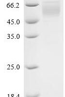 Macaca mulatta Killer immunoglobulin-like receptor KIR3DL2 (KIR3DL), partial Recombinant Protein - BioCrest Sci