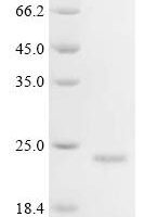 Sheep Inter-alpha-trypsin inhibitor Recombinant Protein - BioCrest Sci