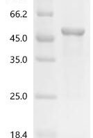 Human [Pyruvate dehydrogenase (acetyl-transferring)] kinase isozyme 1, mitochondrial (PDK1) Recombinant Protein - BioCrest Sci