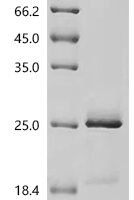 Human Seizure protein 6 homolog (SEZ6), partial Recombinant Protein, N-His-SUMO, aa 768–832 - BioCrest Sci