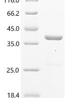Human Vacuolar protein sorting-associated protein 29 (VPS29), partial Recombinant Protein - BioCrest Sci