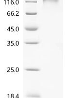 Epstein-Barr virus envelope glycoprotein GP350 (BLLF1), partial Recombinant Protein, C-10His, aa 1–493, strain B95-8 - BioCrest Sci