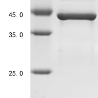 Human Nitric oxide synthase, inducible (NOS2), partial Recombinant Protein - BioCrest Sci
