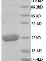 Human cytomegalovirus Cytoplasmic envelopment protein 3 (UL99) Recombinant Protein - BioCrest Sci