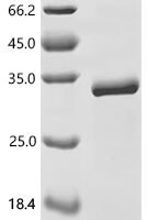 Mouse NAD-dependent protein deacetylase sirtuin-3 (Sirt3), partial Recombinant Protein - BioCrest Sci