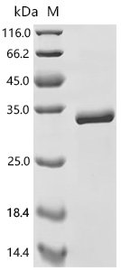 Mouse NAD-dependent protein deacetylase sirtuin-3 (Sirt3), partial Recombinant Protein, Mus musculus (Mouse), E.coli, C-terminal 6xHis-tagged, 35.7 kDa, purity >≥ 95% as determined by SDS-PAGE.