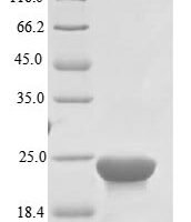 Helicobacter pylori Bacterial non-heme ferritin (ftnA) Recombinant Protein, N-10His, aa 1–167, E.coli - BioCrest Sci