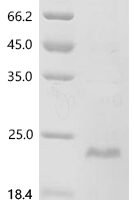 Human Interleukin-9 (IL9) Recombinant Protein, N-His - BioCrest Sci