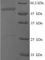 Human Probable dimethyladenosine transferase (DIMT1) Recombinant Protein - BioCrest Sci