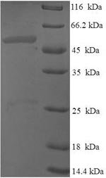 Human Probable dimethyladenosine transferase (DIMT1) Recombinant Protein, Homo sapiens (Human), E.coli, N-terminal 6xHis-SUMO-tagged, 51.2 kDa, purity >≥ 90% as determined by SDS-PAGE.