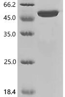 Drosophila melanogaster Kinesin heavy chain (Khc), partial, Biotinylated Recombinant Protein - BioCrest Sci