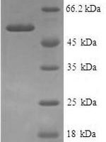 Human Annexin A9 (ANXA9), partial Recombinant Protein - BioCrest Sci