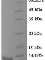 Rat Vasopressin V1b receptor (Avpr1b), partial Recombinant Protein - BioCrest Sci