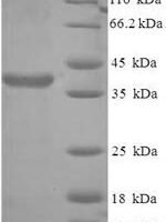 Human Protein SCO2 homolog, mitochondrial (SCO2) Recombinant Protein - BioCrest Sci