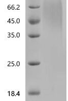 Humulus japonicus Humj1 Recombinant Protein, C-His, aa 1–155, Yeast - BioCrest Sci