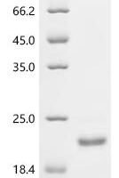 Trichoderma harzianum Endo-1,4-beta-xylanase Recombinant Protein, C-His, aa 1–190, Yeast - BioCrest Sci