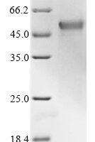 Human Interferon regulatory factor 1 (IRF1) Recombinant Protein, N-10His/C-Myc - BioCrest Sci