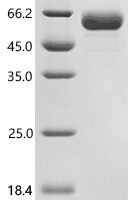 Macaca fascicularis LILRB2 (LILRB2), partial Recombinant Protein - BioCrest Sci