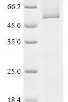 Human UDP-glucuronosyltransferase 1A5 (UGT1A5) Recombinant Protein - BioCrest Sci