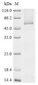 Human UDP-glucuronosyltransferase 1A5 (UGT1A5) Recombinant Protein, Homo sapiens (Human), in vitro E.coli expression system, N-terminal 10xHis-tagged, 58.6 kDa, purity >≥ 85% as determined by SDS-PAGE.