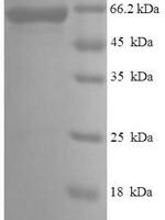 Human Serine/threonine-protein kinase PAK 4 (PAK4) Recombinant Protein - BioCrest Sci