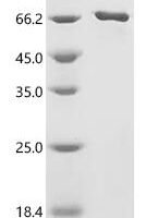 Human Neuronal acetylcholine receptor subunit alpha-7 (CHRNA7), partial, Biotinylated Recombinant Protein - BioCrest Sci
