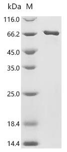 Human Neuronal acetylcholine receptor subunit alpha-7 (CHRNA7), partial, Biotinylated Recombinant Protein, Homo sapiens (Human), E.coli, N-terminal MBP-tagged and C-terminal 6xHis-Avi-tagged, 72.2 kDa, purity >≥ 85% as determined by SDS-PAGE.