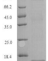 Human/Cynomolgus monkey Activin receptor type-2B (ACVR2B), partial Recombinant Protein, N-His - BioCrest Sci