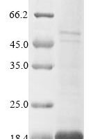 Paracoccus denitrificans Electron transfer flavoprotein-ubiquinone oxidoreductase Recombinant Protein - BioCrest Sci