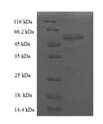 Arabidopsis thaliana Trihelix transcription factor GT-1 (GT-1) Recombinant Protein, N-His, aa 1–406, E.coli - BioCrest Sci