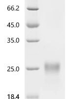 Human Placenta growth factor (PGF) Recombinant Protein, C-10His - BioCrest Sci