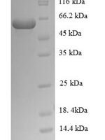 Mycobacterium tuberculosis Steroid C26-monooxygenase (cyp125) Recombinant Protein, N-His-SUMO - BioCrest Sci