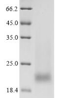 Human Prostate stem cell antigen (PSCA) Recombinant Protein, N-His, aa 12–86, Yeast - BioCrest Sci