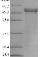 Human Trimethyllysine dioxygenase, mitochondrial (TMLHE) Recombinant Protein - BioCrest Sci