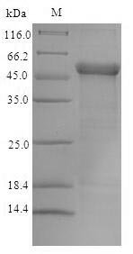 Human Trimethyllysine dioxygenase, mitochondrial (TMLHE) Recombinant Protein, Homo sapiens (Human), E.coli, N-terminal 6xHis-tagged, 46.1 kDa, purity >≥ 90% as determined by SDS-PAGE.