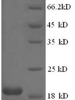 Human papillomavirus type 18 Protein E7 (E7) Recombinant Protein, N-His, aa 1–105, E.coli - BioCrest Sci