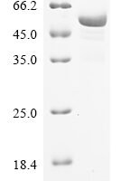 Mouse Sodium/potassium-transporting ATPase subunit alpha-1 (Atp1a1), partial Recombinant Protein - BioCrest Sci