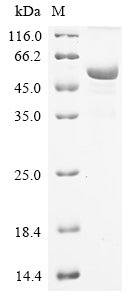 Mouse Sodium/potassium-transporting ATPase subunit alpha-1 (Atp1a1), partial Recombinant Protein, Mus musculus (Mouse), E.coli, N-terminal 6xHis-tagged, 53.3 kDa, purity >≥ 85% as determined by SDS-PAGE.