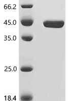 Human Activating signal cointegrator 1 complex subunit 3 (ASCC3), partial Recombinant Protein - BioCrest Sci