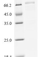 Human Desmoglein-3 (DSG3), partial, Biotinylated Recombinant Protein - BioCrest Sci
