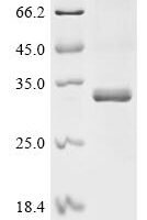 Human Transcriptional enhancer factor TEF-4 (TEAD2), partial Recombinant Protein, N-10His/C-Myc, aa 217–447 - BioCrest Sci