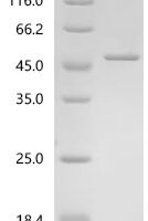 Mouse Ataxin-3 (Atxn3) Recombinant Protein, C-His - BioCrest Sci