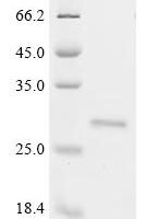 Bos indicus x Bos taurus Kappa-casein, partial (R118C) Recombinant Protein - BioCrest Sci