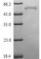 Influenza A virus Nucleoprotein (NP) Recombinant Protein, N-His - BioCrest Sci