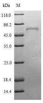 Influenza A virus Nucleoprotein (NP) Recombinant Protein, N-His, Influenza A virus, E.coli, N-terminal 6xHis-tagged, 60.2 kDa, purity >≥ 90% as determined by SDS-PAGE.