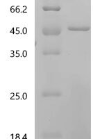 Human Angiopoietin-related protein 6 (ANGPTL6), partial Recombinant Protein - BioCrest Sci
