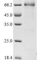 Human Serpin B7 (SERPINB7) Recombinant Protein, N-GST, aa 1–380, Yeast - BioCrest Sci