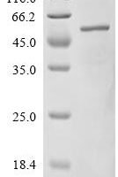 Mouse Interferon-inducible protein AIM2 (Aim2) Recombinant Protein - BioCrest Sci