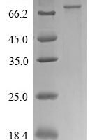 Human CTP synthase 1 (CTPS1) Recombinant Protein - BioCrest Sci